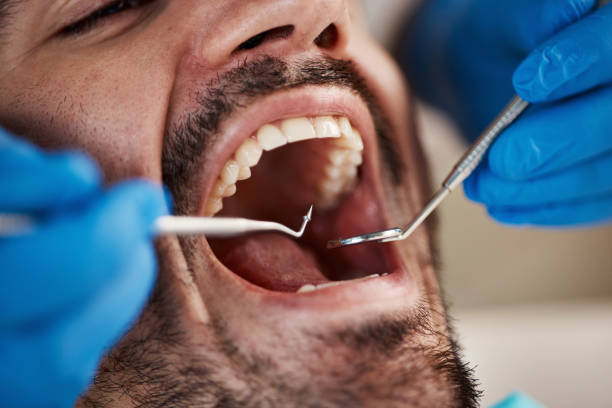 Best Pediatric Emergency Dentist in Marvin, NC